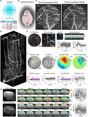 Chronic Cranial Windows for Long Term Multimodal Neurovascular Imaging in Mice